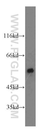 CaMKII delta Antibody in Western Blot (WB)