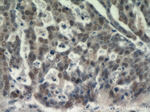 CTR9 Antibody in Immunohistochemistry (Paraffin) (IHC (P))