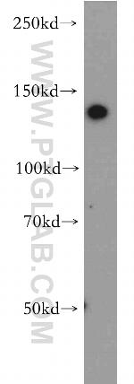 CTR9 Antibody in Western Blot (WB)