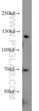 CTR9 Antibody in Western Blot (WB)