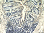 IL17RB Antibody in Immunohistochemistry (Paraffin) (IHC (P))