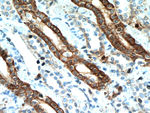 IL17RB Antibody in Immunohistochemistry (Paraffin) (IHC (P))