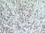 IL17RB Antibody in Immunohistochemistry (Paraffin) (IHC (P))