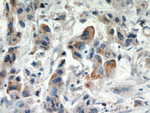 IL17RB Antibody in Immunohistochemistry (Paraffin) (IHC (P))