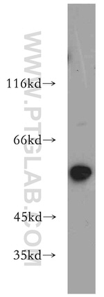 SLC16A2 Antibody in Western Blot (WB)