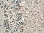 LIS1 Antibody in Immunohistochemistry (Paraffin) (IHC (P))