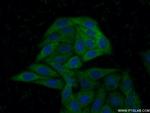 ABCA2 Antibody in Immunocytochemistry (ICC/IF)