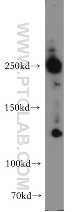 ABCA2 Antibody in Western Blot (WB)