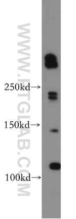 ABCA2 Antibody in Western Blot (WB)