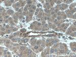 FLNB Antibody in Immunohistochemistry (Paraffin) (IHC (P))