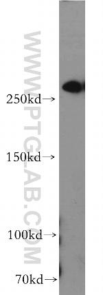 FLNB Antibody in Western Blot (WB)