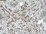 NOTCH1 Antibody in Immunohistochemistry (Paraffin) (IHC (P))