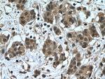 NOTCH1 Antibody in Immunohistochemistry (Paraffin) (IHC (P))