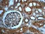 PAWR Antibody in Immunohistochemistry (Paraffin) (IHC (P))