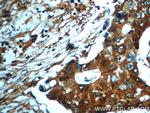 PAWR Antibody in Immunohistochemistry (Paraffin) (IHC (P))