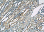 SSTR3 Antibody in Immunohistochemistry (Paraffin) (IHC (P))