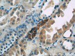 SSTR3 Antibody in Immunohistochemistry (Paraffin) (IHC (P))