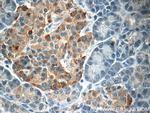 SSTR3 Antibody in Immunohistochemistry (Paraffin) (IHC (P))