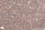 SSTR3 Antibody in Immunohistochemistry (Paraffin) (IHC (P))