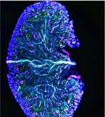 SHH Antibody in Immunocytochemistry (ICC/IF)