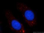 SHH Antibody in Immunocytochemistry (ICC/IF)