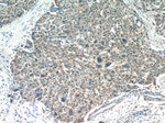 SHH Antibody in Immunohistochemistry (Paraffin) (IHC (P))