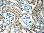 SHH Antibody in Immunohistochemistry (Paraffin) (IHC (P))