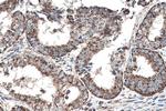 SHH Antibody in Immunohistochemistry (Paraffin) (IHC (P))