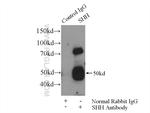 SHH Antibody in Immunoprecipitation (IP)