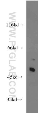 SHH Antibody in Western Blot (WB)