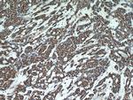 TOP1 Antibody in Immunohistochemistry (Paraffin) (IHC (P))