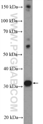 FGF8 Antibody in Western Blot (WB)