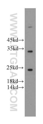 FGF8 Antibody in Western Blot (WB)