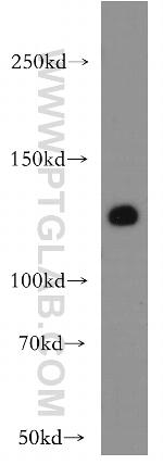 VEGFR3 Antibody in Western Blot (WB)