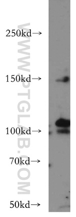 VEGFR3 Antibody in Western Blot (WB)