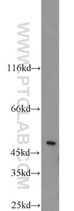 GHRHR Antibody in Western Blot (WB)