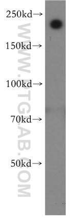 MYH14 Antibody in Western Blot (WB)