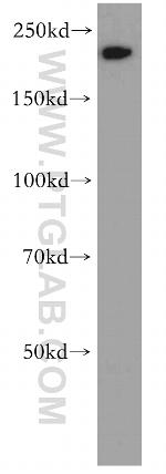 MYH14 Antibody in Western Blot (WB)