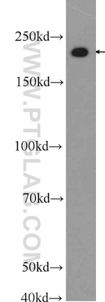 MYH14 Antibody in Western Blot (WB)