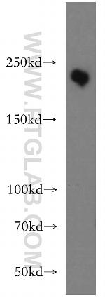 MYO7A Antibody in Western Blot (WB)