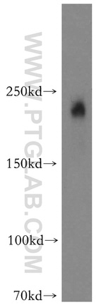 MYO7A Antibody in Western Blot (WB)