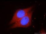 SYNM Antibody in Immunocytochemistry (ICC/IF)