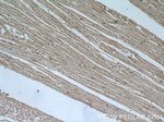 SYNM Antibody in Immunohistochemistry (Paraffin) (IHC (P))