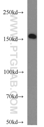 SYNM Antibody in Western Blot (WB)