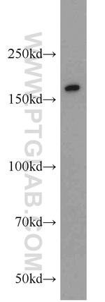 SYNM Antibody in Western Blot (WB)