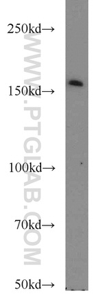 SYNM Antibody in Western Blot (WB)