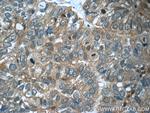 CFTR Antibody in Immunohistochemistry (Paraffin) (IHC (P))