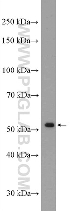 ARX Antibody in Western Blot (WB)