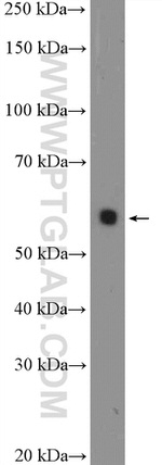 ARX Antibody in Western Blot (WB)