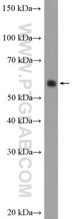 ARX Antibody in Western Blot (WB)